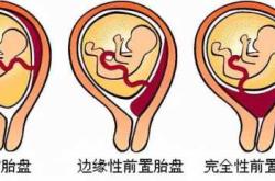 备孕前需要做脑磁共振吗