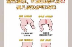 婴儿湿疹怎么弄才能好起来