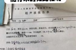 孕反大便稀疏怎么办