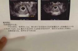 什么时候能查出怀孕