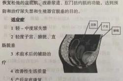 产后尿不出来该怎么处理