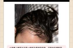 婴儿嗜睡是什么原因呢