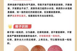 新生儿脸上长湿疹怎么办