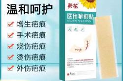 剖腹产刀口发红怎么办