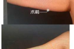 婴儿胳膊粗是正常现象吗