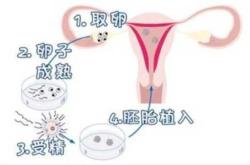 弱精能怀孕吗