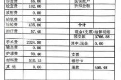 流产后花费要多少