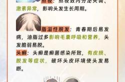 产后掉头发啥原因很关键