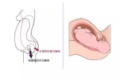 顺产阴道能恢复吗