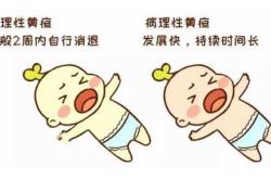 新生儿僵直是何原因所致