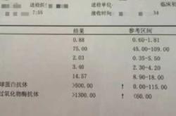 甲减备孕需检查甲功几项