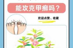 怀孕能包指甲花吗