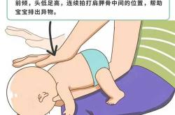 婴儿拍头是怎么回事