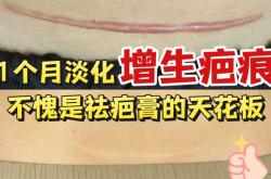 剖腹产疤痕增生期时长是多久
