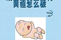 刚出生婴儿黄疸该怎么办