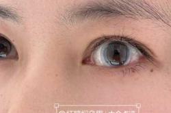 婴儿剪睫毛有什么影响