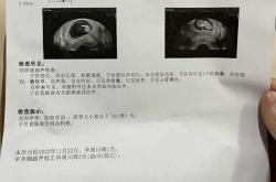 孕19周开始孕反正常吗