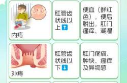 顺产后屁股变大怎么办