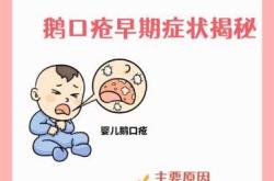 新生儿口腔内要注意什么