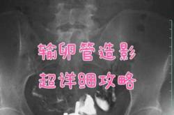 四联法吃完多久能备孕