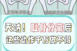 产后耻骨修复方法有哪些