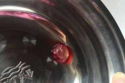 自然流产后三天小腹痛正常吗