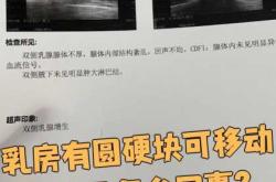 乳腺增生能怀孕吗