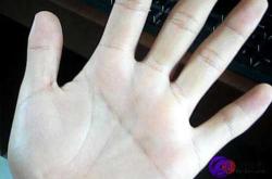 婴儿通贯手意味着什么