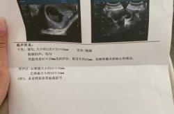 孕15周为何晚上孕反厉害