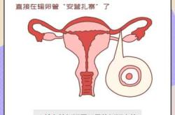 备孕检查输卵管还有什么