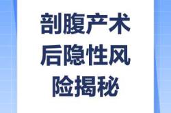 你是剖腹产啊是真的吗