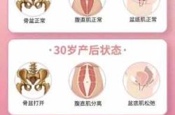 产后耻骨联合分离多久恢复