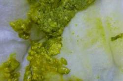 婴儿果酱样大便怎么回事