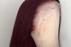 婴儿拔头发怎么办