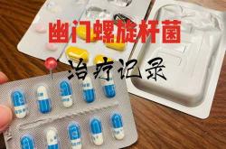 备孕能不能检测幽门螺杆菌