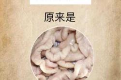 齐鲁医院青岛剖腹产有啥注意