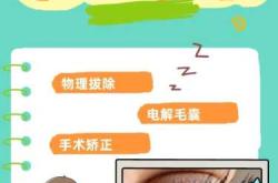婴儿倒睫毛怎么办