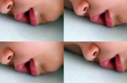 新生儿流口水正常吗