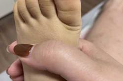 刚出生的婴儿皮肤为何这样