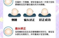 婴儿扁头怎么办能矫正吗