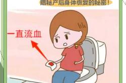 月子期间大便出血怎么办