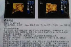 孕九周孕反浑身发冷咋回事