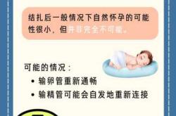 剖腹产能否同时结扎