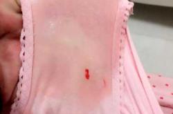 孕61天孕反减弱正常吗