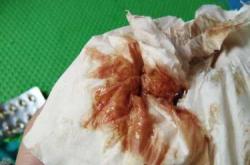 婴儿拉屎绿色是怎么回事