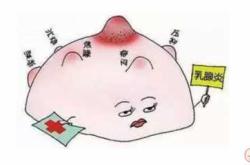 引产后多久能回奶合适