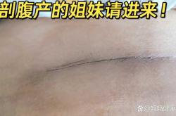 产后多久可以洗澡洗头