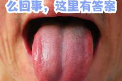 产后舌头涩是何原因所致