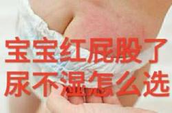 尿不湿偏大还是偏小怎么选
