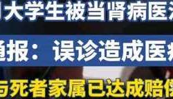 得了肾炎会影响备孕吗